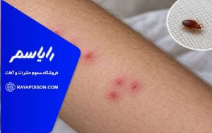 جای گزش ساس